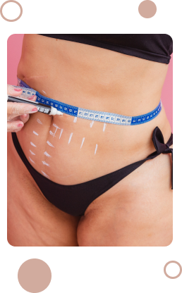 Pós-operatório da Mommy Makeover Pós-operatório da Mommy Makeover